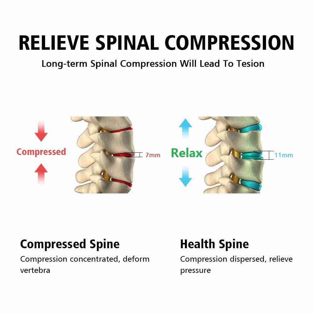 Is Your Back getting on Your Nerves? Spinal Decompression May Help.